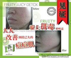 Fruity Juicy Detox