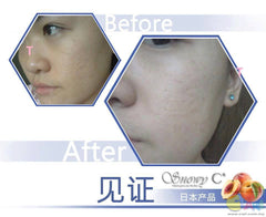 ♥Snowy C+ Collagen胶原蛋白