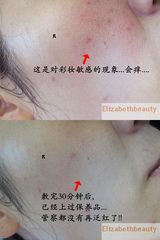 台湾超红超多好评-台湾DMC欣蘭黑裡透白凍膜 可治疗敏感肌肤 225g