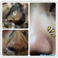 台湾超红超多好评-台湾DMC欣蘭黑裡透白凍膜 可治疗敏感肌肤 225g